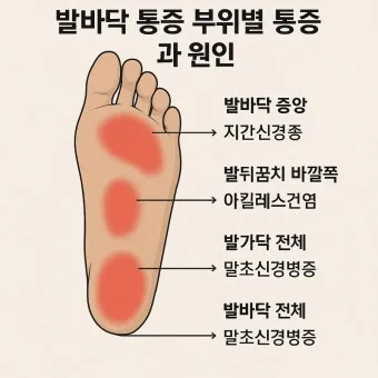 발바닥 가려움증 증상 4가지 이유 원인 치료법_3