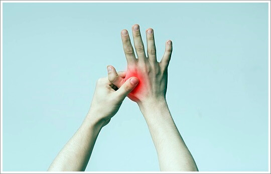 류마티스 관절염 초기증상