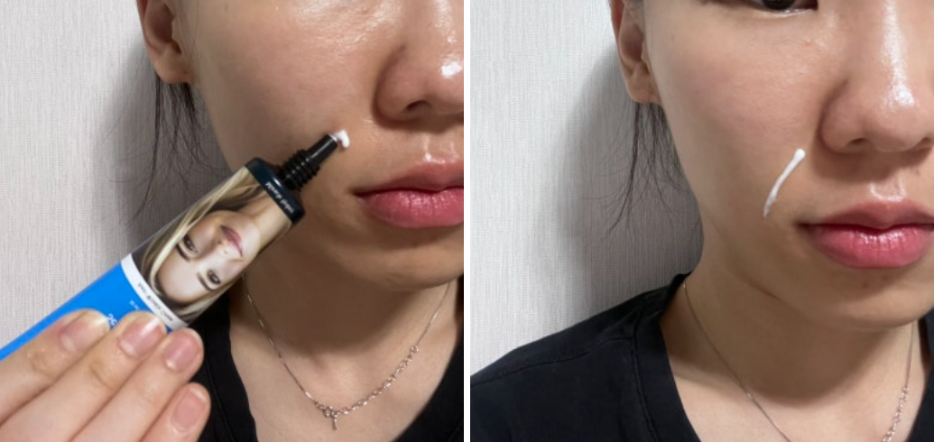 미라클시드니 시리즈a 사용