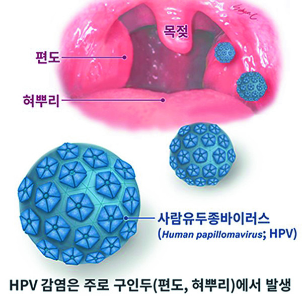 (편도암 아는것이 힘)