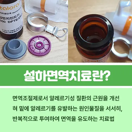 설하면역치료