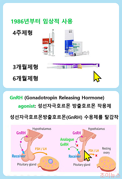 진성 성조숙증 치료_이미지출처:의학채널비온뒤