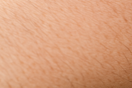 쯔쯔가무시 진드기 물린 자국