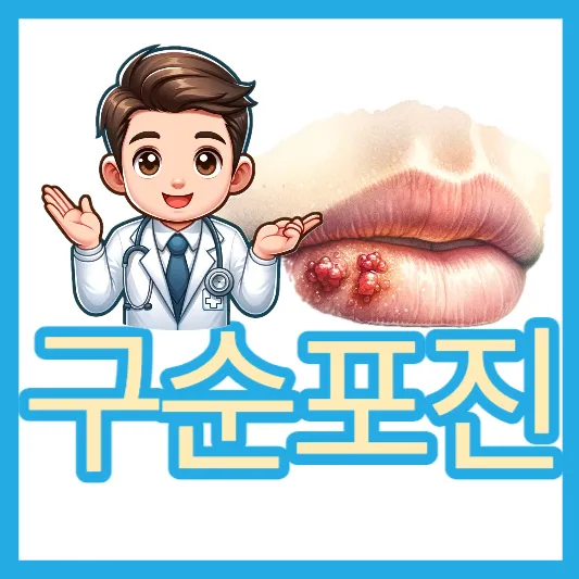 구순포진 소개