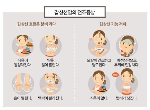 여성질환: 갑상선암- 원인, 초기증상, 완치율.