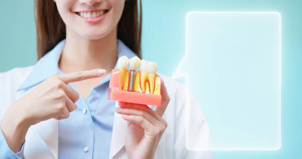 어금니 임플란트 가격, 얼마나 들까? (2025년 기준)