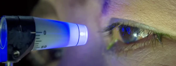 안압 측정법을 설명하는 이미지. 접촉 안압계 방식을 소개하는 이미지로 이외에 비접촉 안압계 사용법도 있습니다.