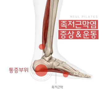 발바닥통증의 원인들과 해결책_9