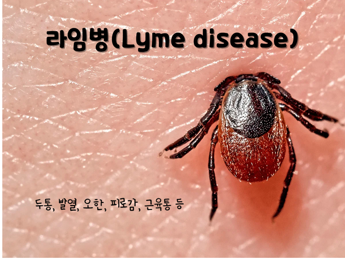 라임병(Lyme disease)
보렐리아 부르그도르페리라는 세균에 의해 발생.
진드기에 의해 사람에게 전파.
초기 증상 : 두통, 발열, 오한, 피로감, 근육통 등