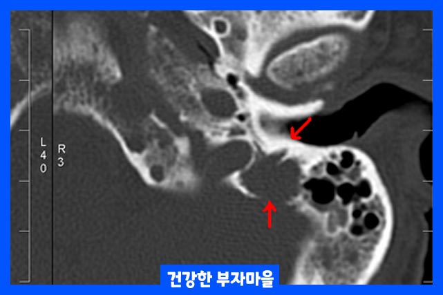 연령, 성병, 유전적 요인이 원인