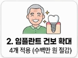 2. [의료] 부모님 임플란트 4개까지 보험 적용! 수백만 원 절감법