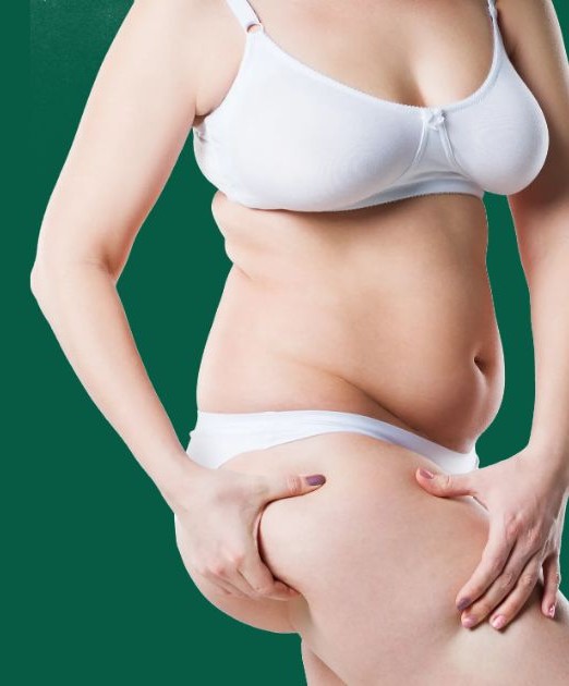 ldl콜레스테롤 정상수치 연상이미지