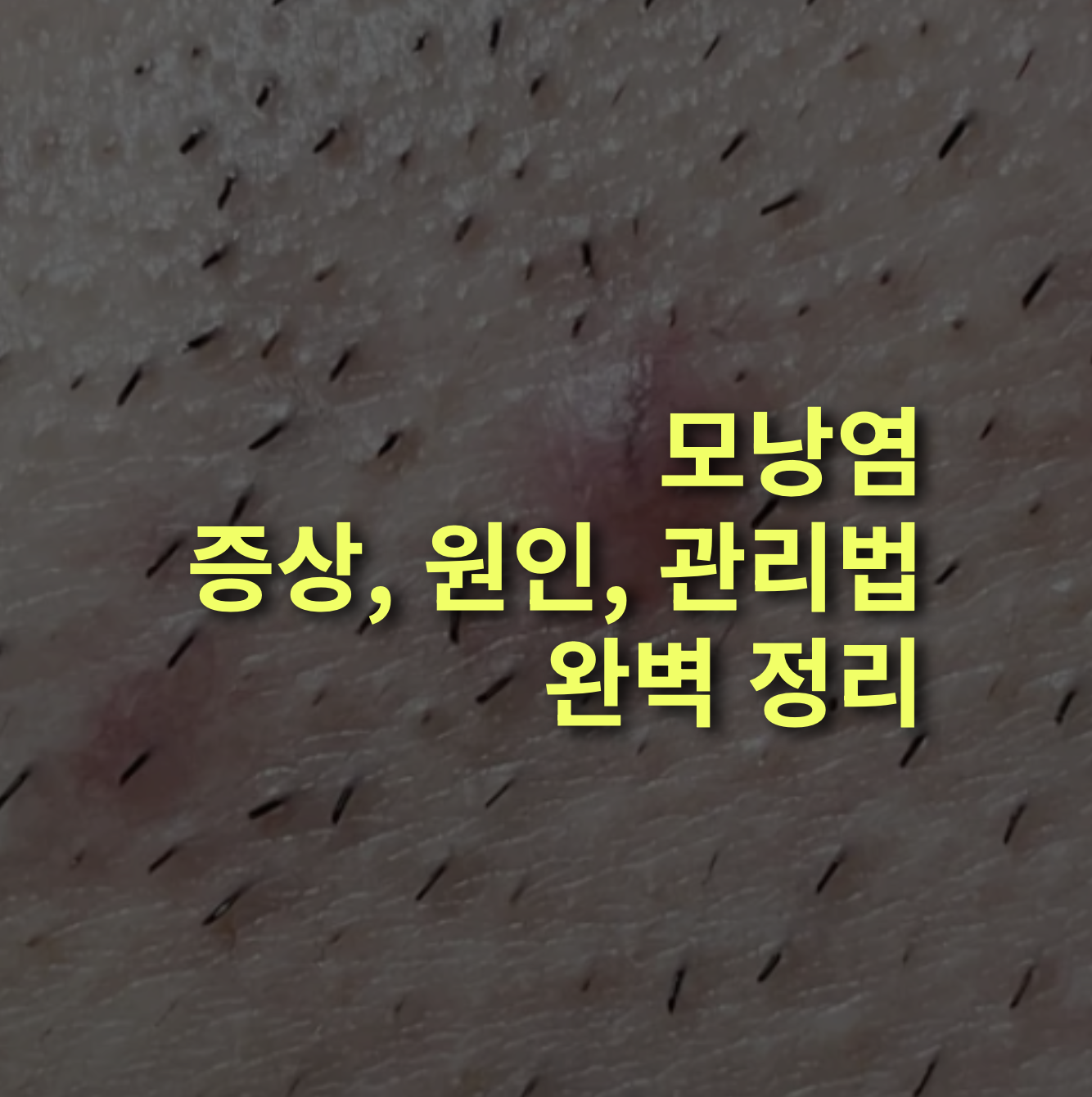모낭염 증상과 원인, 관리 방법은? 왁싱, 뾰루지.