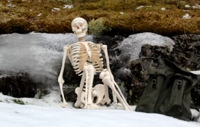 연골주사란 연골주사 부작용 가격 효과