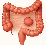 선종 뜻 선종과 용종의 차이