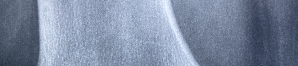 콘드로이친 효능 이미지