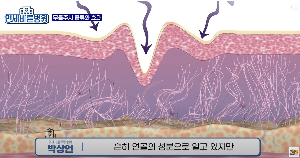 연골 성분