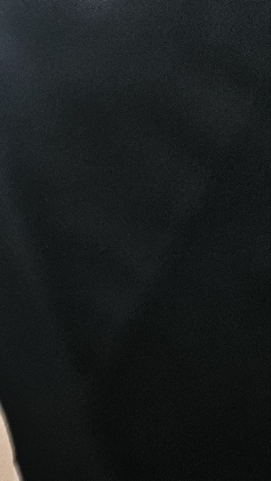 수족구병 증상 격리기간