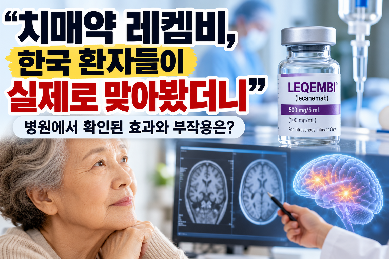 치매 치료제 레켐비의 국내 환자 치료 결과와 부작용