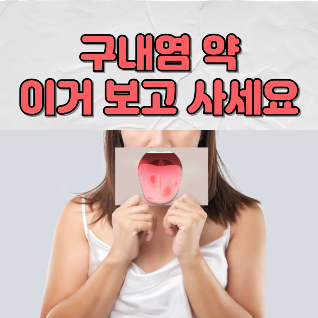 구내염 관련 사진