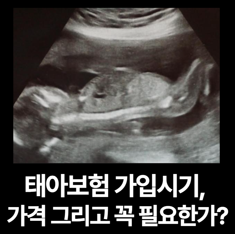 태아보험 가입시기