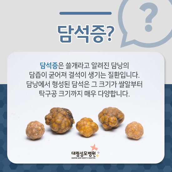 담석