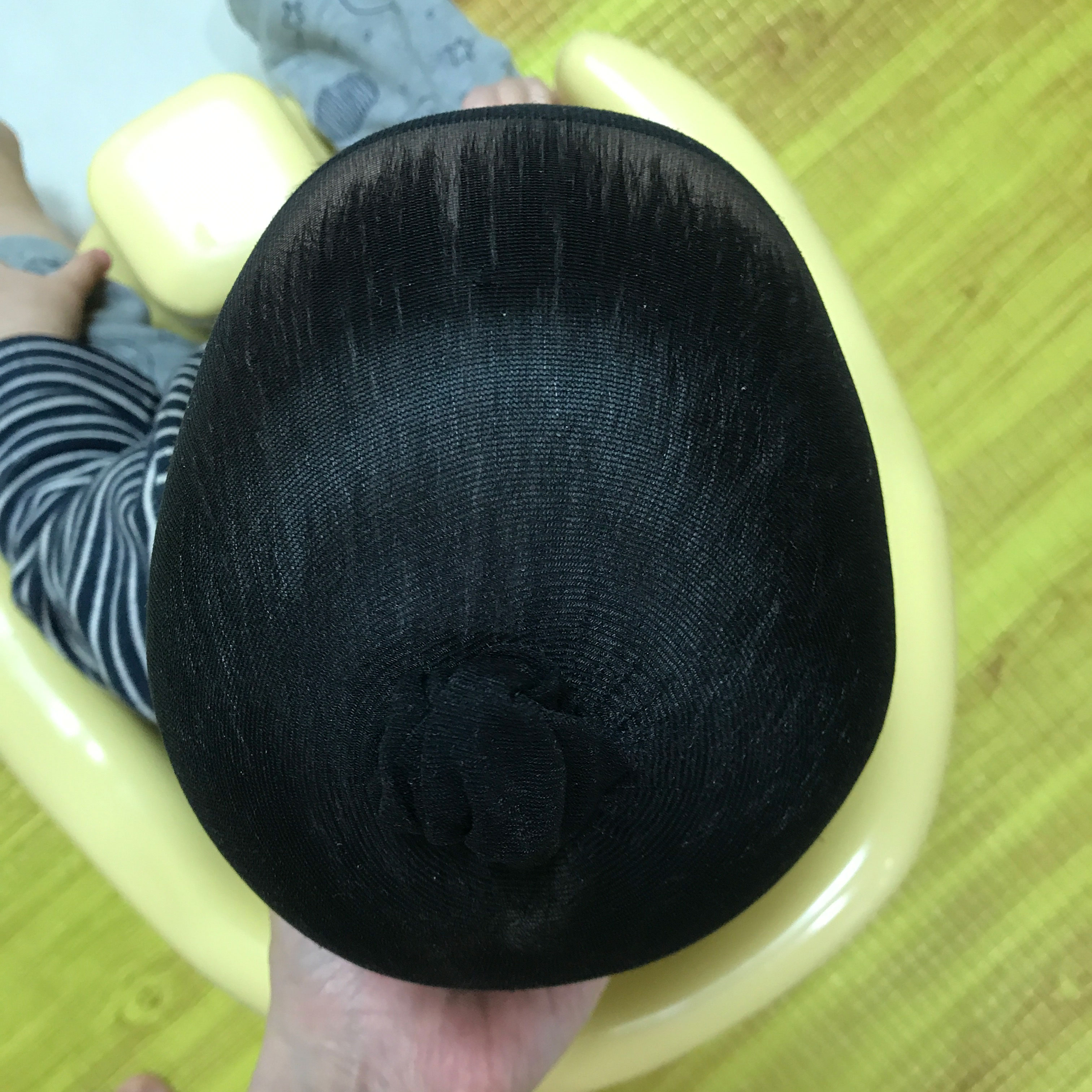 아기 사두증 - 셀프 교정 5개월, 두상 교정 완료