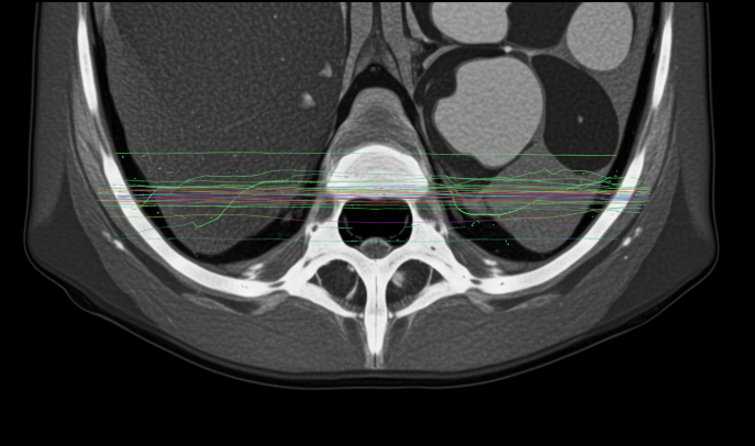 CT 검출기 오작동 사례, 안전관리 어떻게 해야 할까?