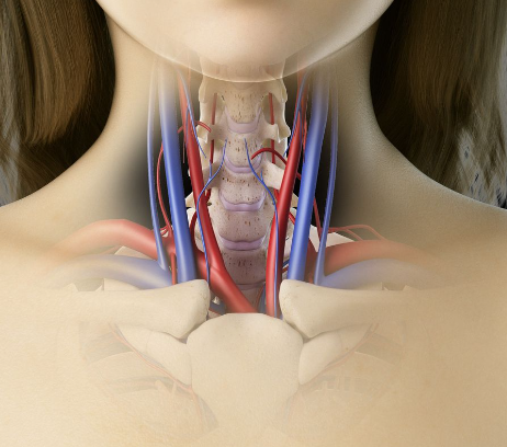 경동맥 초음파 검사란? mra 플라크 수치