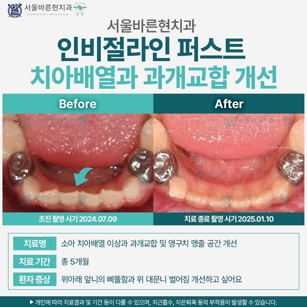 부산해운대인비절라인퍼스트