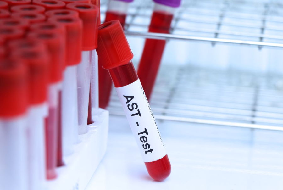 AST/ALT 수치 강조한 인포그래픽