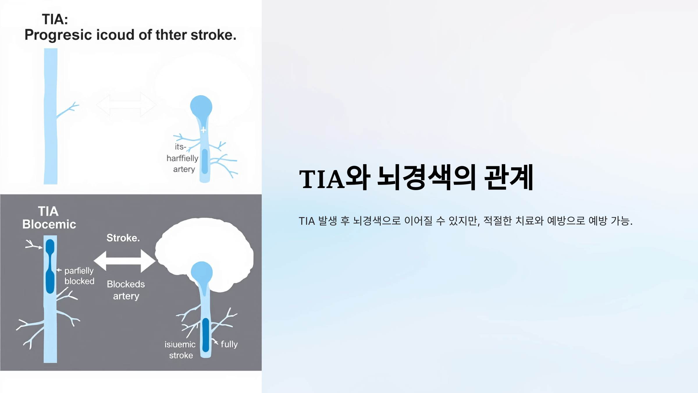 뇌경색과 관련된 사진입니다.