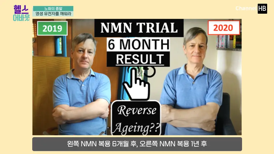 일본NMN36000