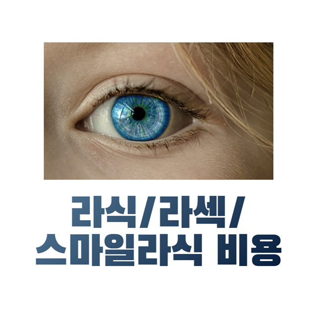 라식, 라섹, 스마일라식 비용