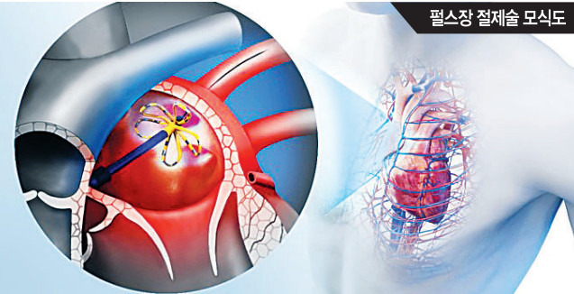 부정맥-심방세동-펄스장-절제술-시술-비용-병원-명의