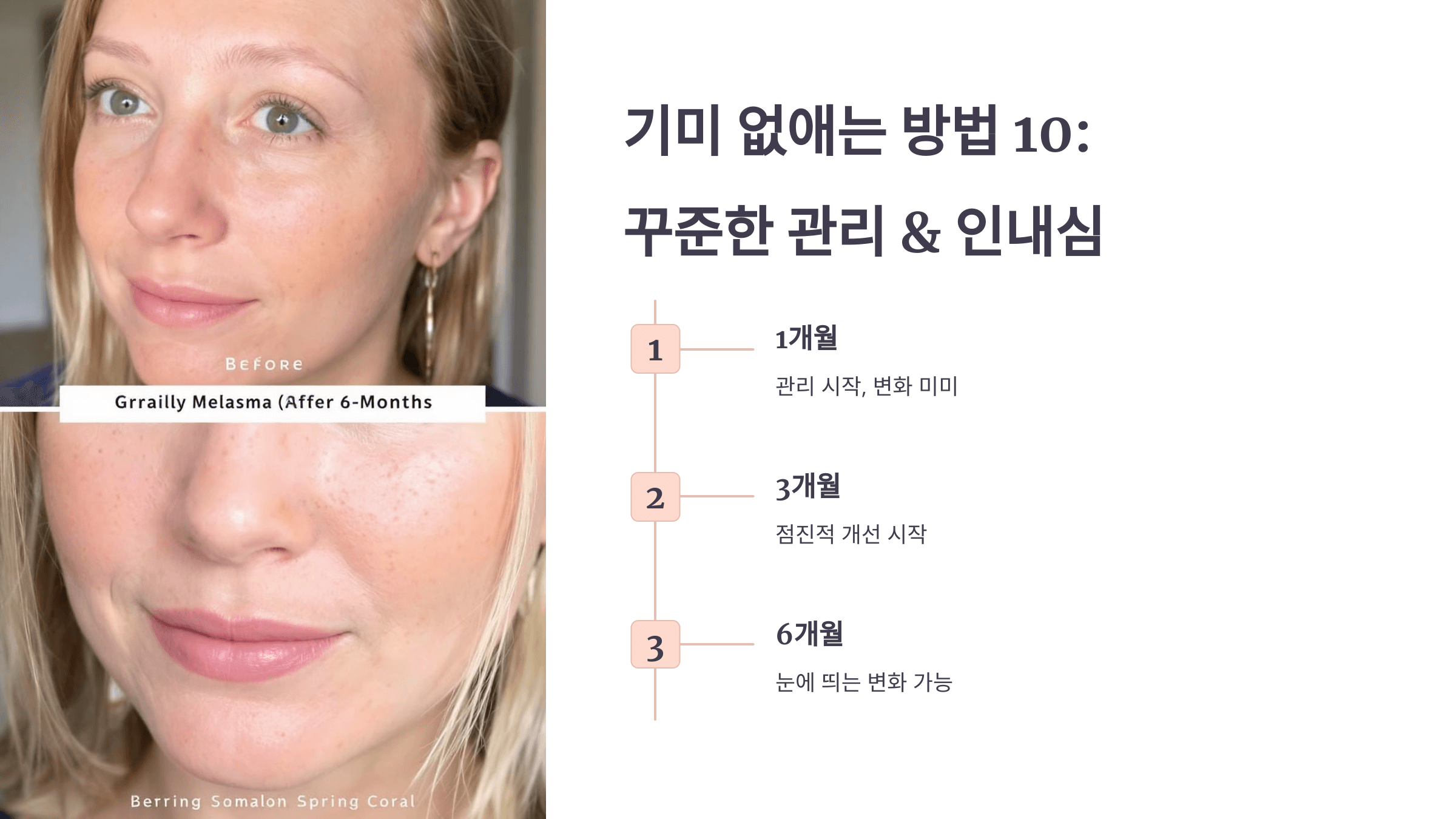 기미와 관련된 사진입니다.