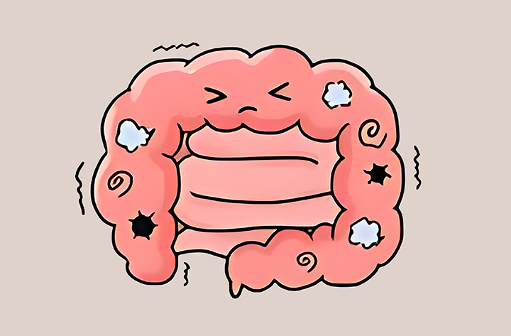 소화-불량인-장의-모습