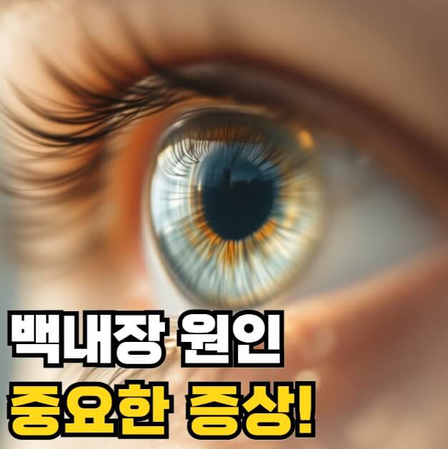 백내장 원인과 증상