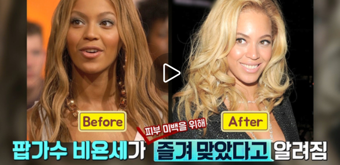 백옥주사 비욘세