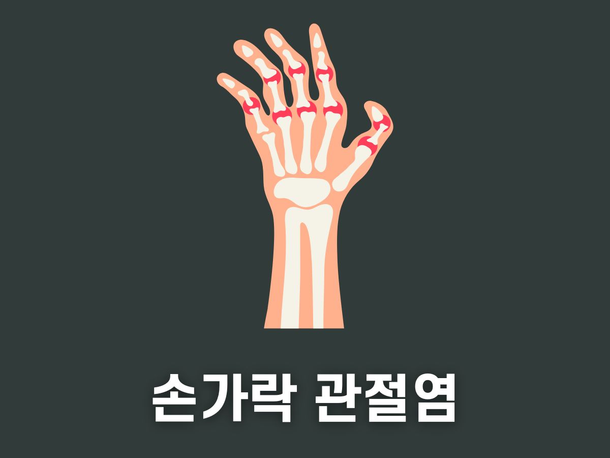 손가락 관절염