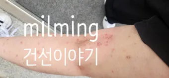 에로콤크림 코르티코이드 반응성 피부질환에서의 염증가려움 완화 전략에 대한 사용수칙_11