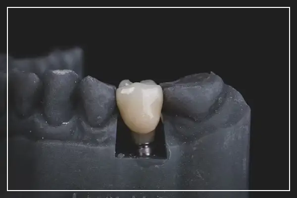 이빨 빠지는 꿈, 무슨 뜻일까? 심리 해석부터 건강 신호까지