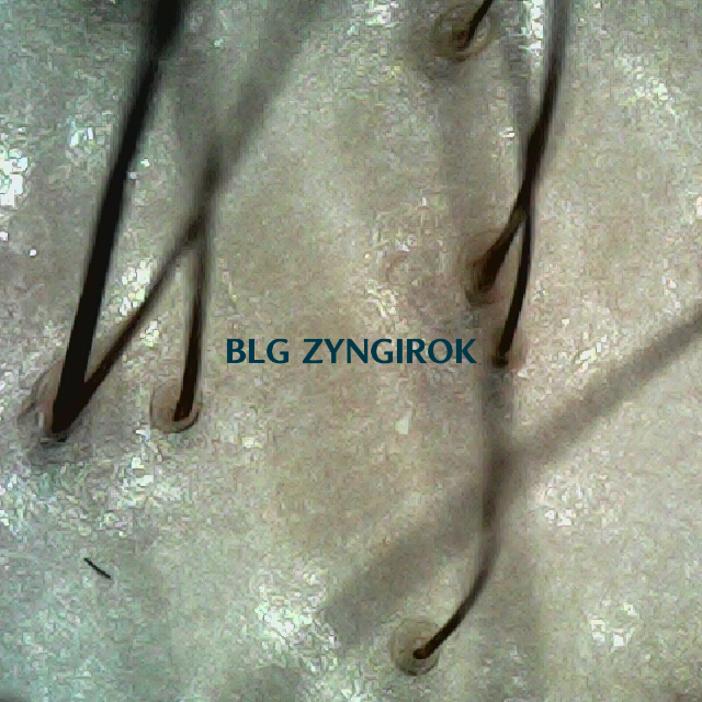 파나모아 복용 2주차 정수리와 이마사이 부분 두피사진 모습이다.