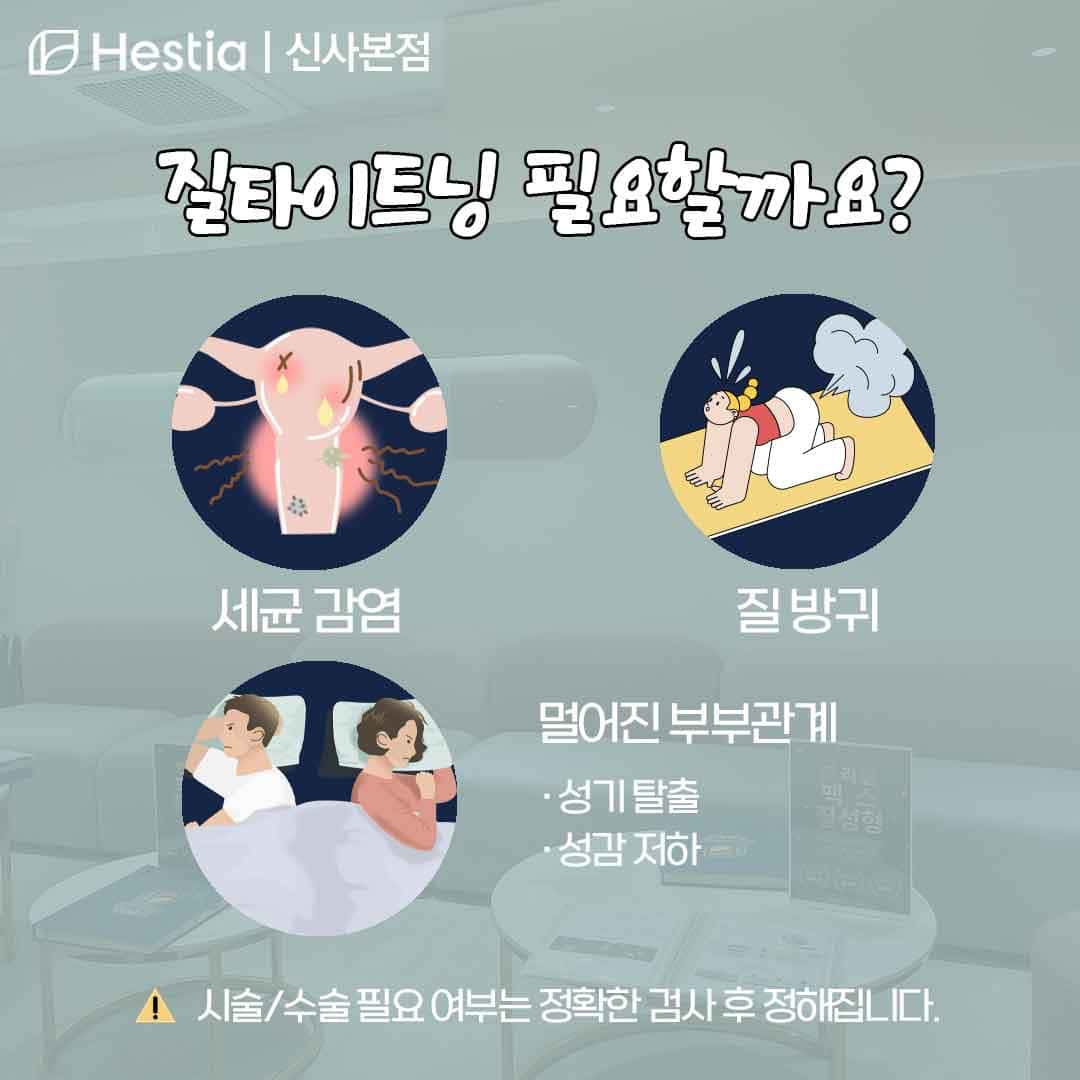 질타이트닝 질방귀 질타이트닝 필요할까요?