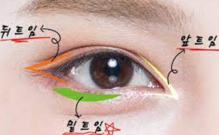 눈 성형수술