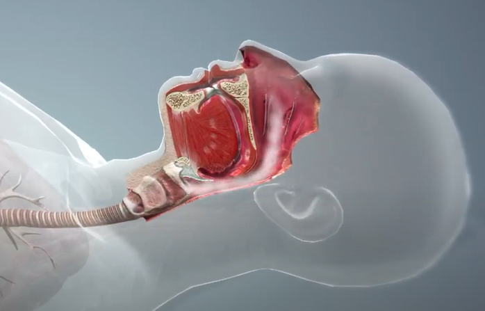 코골이가 발생하기 전