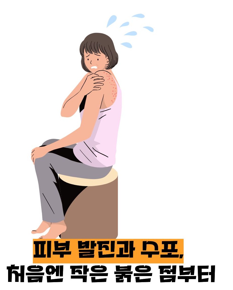 대상포진 초기증상
