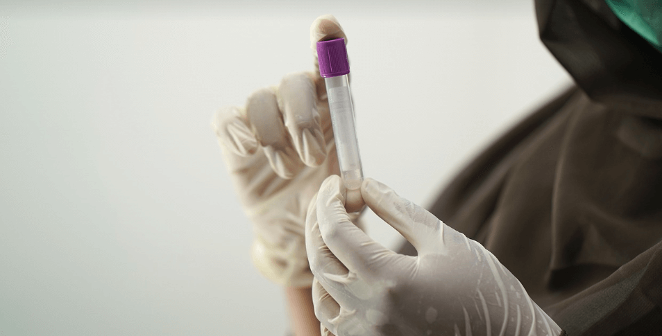 간이 안 좋을 때 나타나는 증상과 관련된 사진 - 14