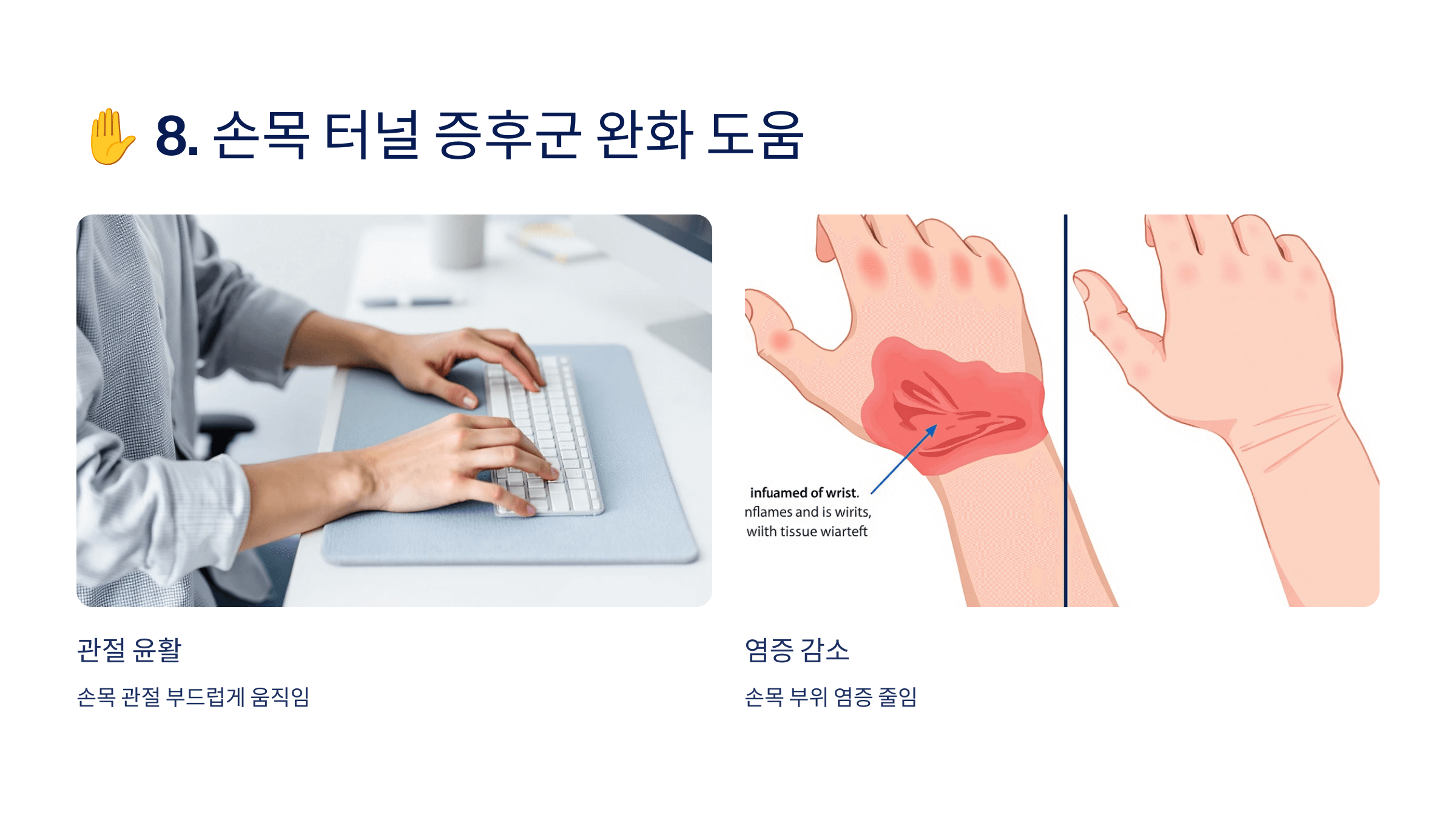 콘드로이친과 관련된 사진입니다.