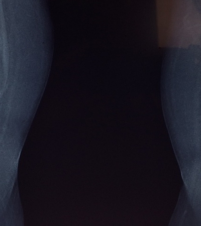 양파 효능 사진11